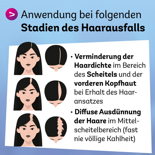 Minoxidil Dexcel 20 mg/ml Spray Z.anw.a.d.kopfhaut 60 ml Dexcel Pharma bei onfy.de kaufen 18892393
