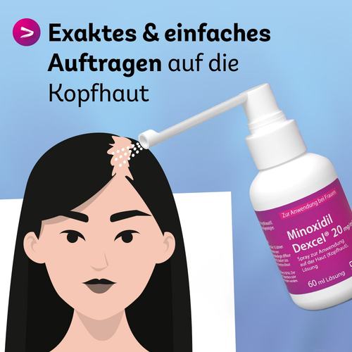 Minoxidil Dexcel 20 mg/ml Spray Z.anw.a.d.kopfhaut 60 ml Dexcel Pharma bei onfy.de kaufen 18892393