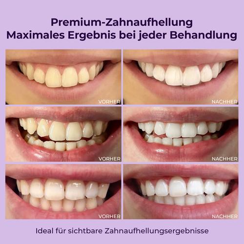 OnlySmile Zahnaufhellungsgel (Zubehör) 40 ml Hager Pharma bei onfy.de kaufen 20129339