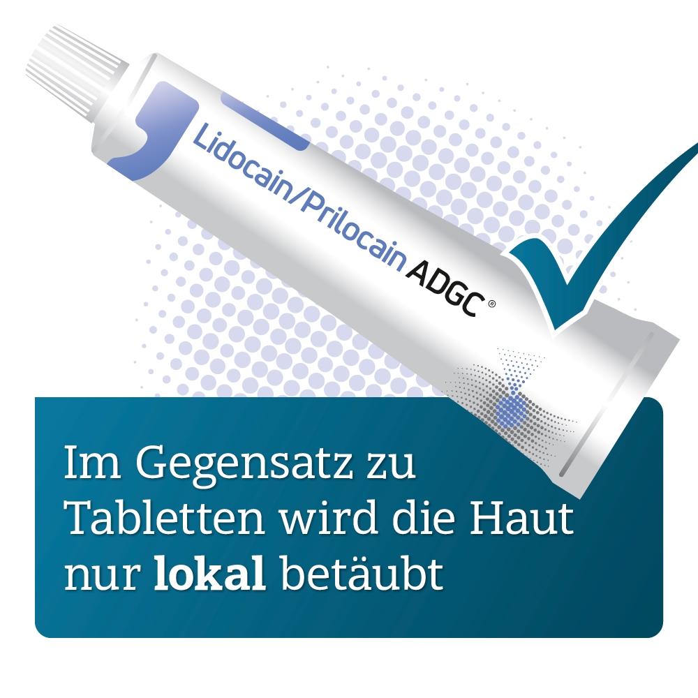Lidocain/Prilocain Adgc 25 mg/G + 25 mg/G Creme 30 g Zentiva Pharma bei onfy.de kaufen 19360853