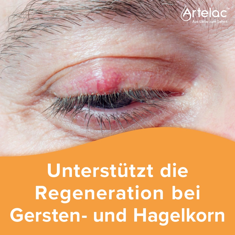 Artelac Augenlidhelfer 15 g Dr. Gerhard Mann bei onfy.de kaufen 19924468