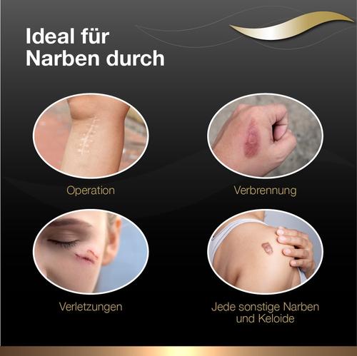 Dermatix Ultra Narben Gel 15 g Cooper Consumer Health Deutschland bei onfy.de kaufen 06090286