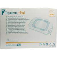 Tegaderm Plus Pad 9 x 10 cm null