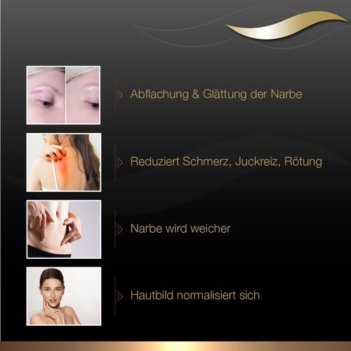 Dermatix Ultra Narben Gel 15 g Cooper Consumer Health Deutschland bei onfy.de kaufen 06090286