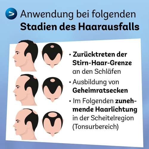 Minoxidil Dexcel 50 mg/ml Spray Z.anw.a.d.kopfhaut 3x60 ml Dexcel Pharma bei onfy.de kaufen 18892424