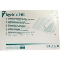 Tegaderm Film 15.0 cmx20.0 cm null
