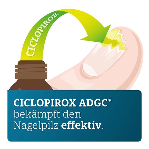 Ciclopirox Adgc 80 mg/G Wirkstoffhalt. Nagellack 6.6 ml Zentiva Pharma bei onfy.de kaufen 17184228
