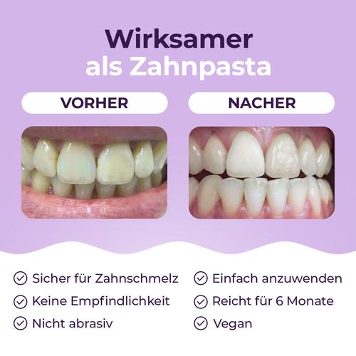 Onlysmile Zahnaufhellungspulver 75 g Hager Pharma bei onfy.de kaufen 20129351