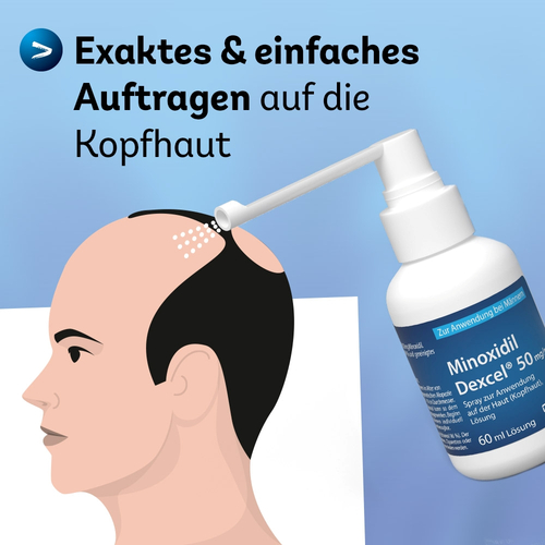 Minoxidil Dexcel 50 mg/ml Spray Z.anw.a.d.kopfhaut 3x60 ml Dexcel Pharma bei onfy.de kaufen 18892424