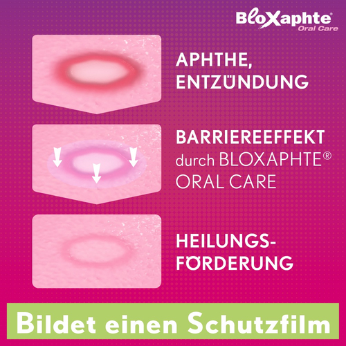 Bloxaphte Oral Care Mund-Gel 15 ml Dr. Gerhard Mann bei onfy.de kaufen 13983211