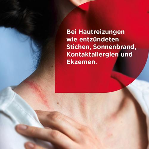 Soventol HydroCortisonACETAT 0.5% Hautentzündungen 30 g MEDICE Arzneimittel Pütter bei onfy.de kaufen 10714367